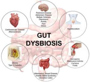 Gut Dysbiosis